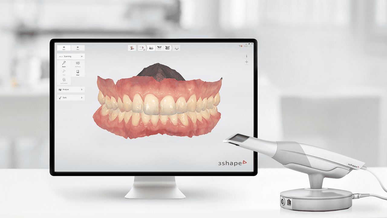 3D口內掃描 3D口內掃描