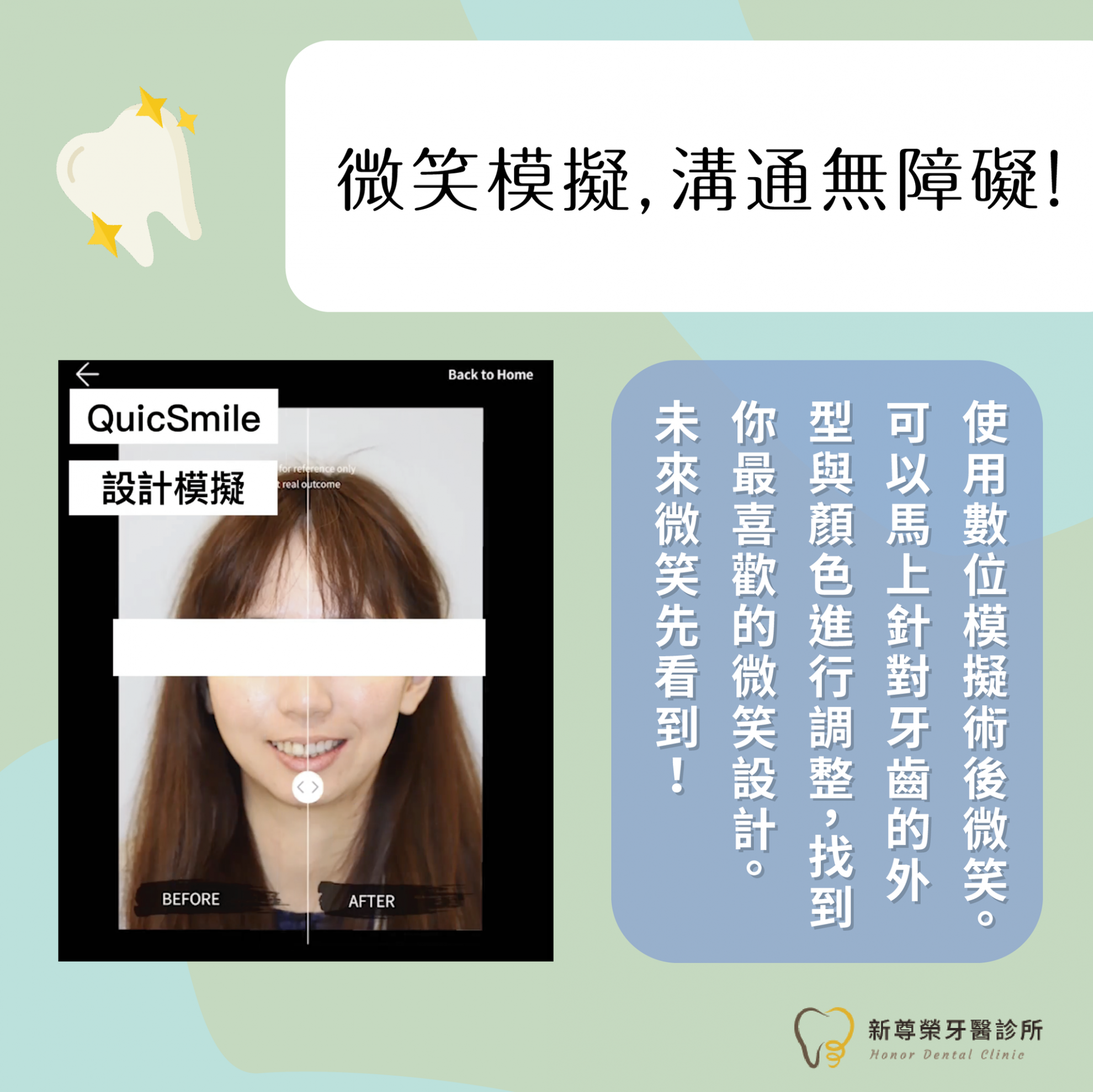 陶瓷貼片 陶瓷貼片