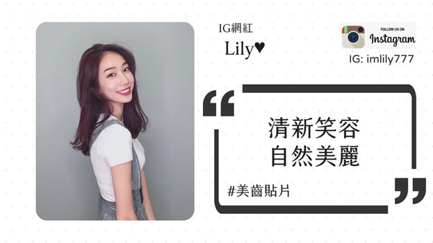 陶瓷貼片 陶瓷貼片