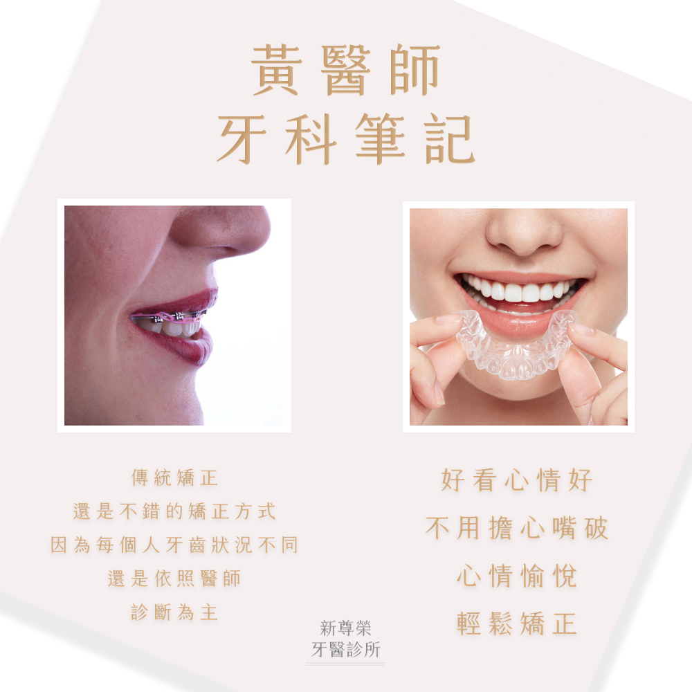 【黃醫師牙科筆記】什麼是隱形矯正呢? 【黃醫師牙科筆記】什麼是隱形矯正呢?